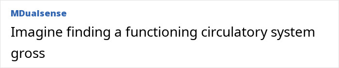 This Influencer Removed A Vein From Her Forehead Because It Bothered Her Aesthetically And Shared The Results