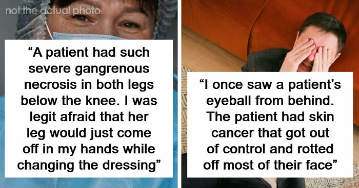 45 Medical Professionals Share Patient Stories That Are Definitely Not For The Weak