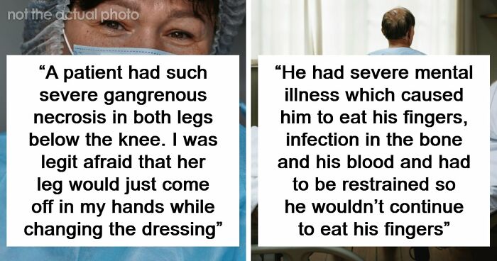 45 Medical Professionals Share Patient Stories That Are Definitely Not For The Weak