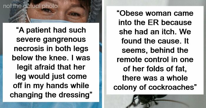 45 Medical Professionals Share Patient Stories That Are Definitely Not For The Weak