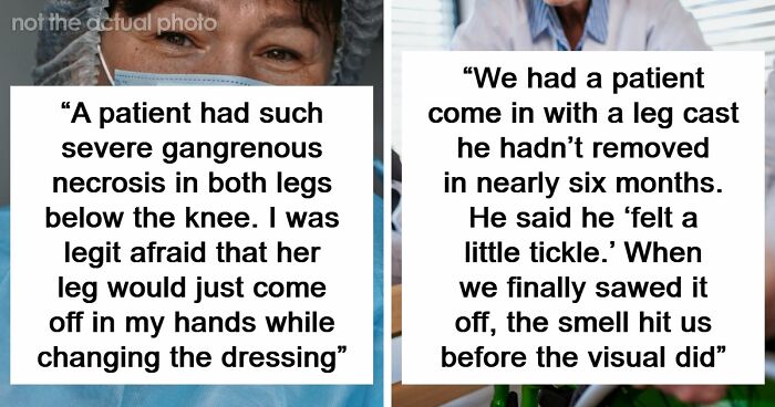45 Medical Professionals Share Patient Stories That Are Definitely Not For The Weak