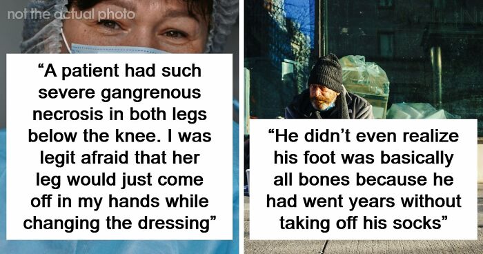 45 Medical Professionals Share Patient Stories That Are Definitely Not For The Weak