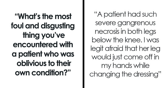 45 Medical Professionals Share Patient Stories That Are Definitely Not For The Weak