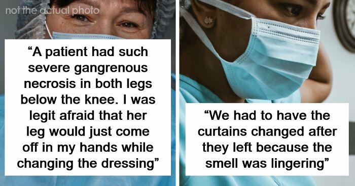 45 Medical Professionals Share Patient Stories That Are Definitely Not For The Weak