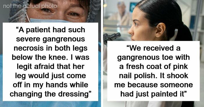 45 Medical Professionals Share Patient Stories That Are Definitely Not For The Weak