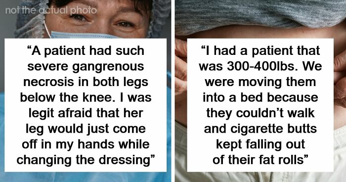45 Medical Professionals Share Patient Stories That Are Definitely Not For The Weak
