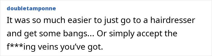 This Influencer Removed A Vein From Her Forehead Because It Bothered Her Aesthetically And Shared The Results