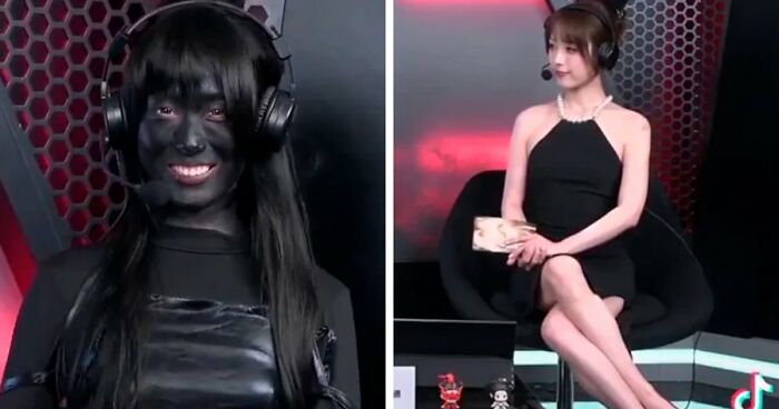 ‘Looksmaxxing’ Influencer Clavicular Breaks Silence After ‘Brutal’ Hospitalization Following Live Incident