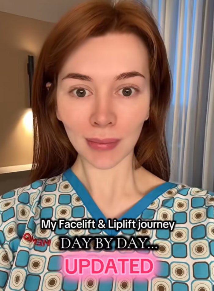 A woman with red hair in a blue patterned scrub top shares her facelift journey. A debate rages on society's new normal.