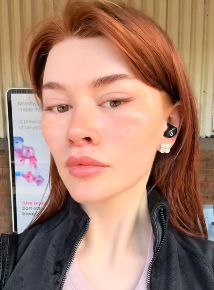 A young woman with red hair and full lips wearing a black jacket, an earbud, and flower earrings. Facelift debate.