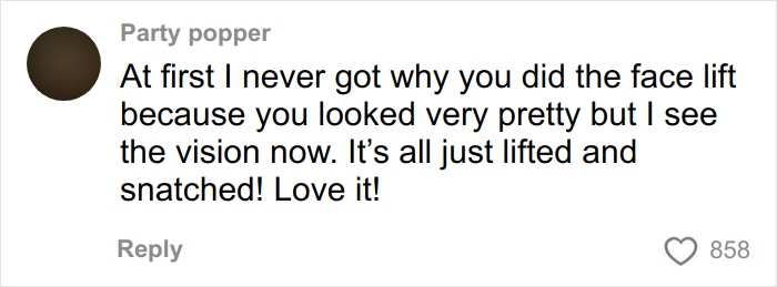 A social media comment praising a facelift: 