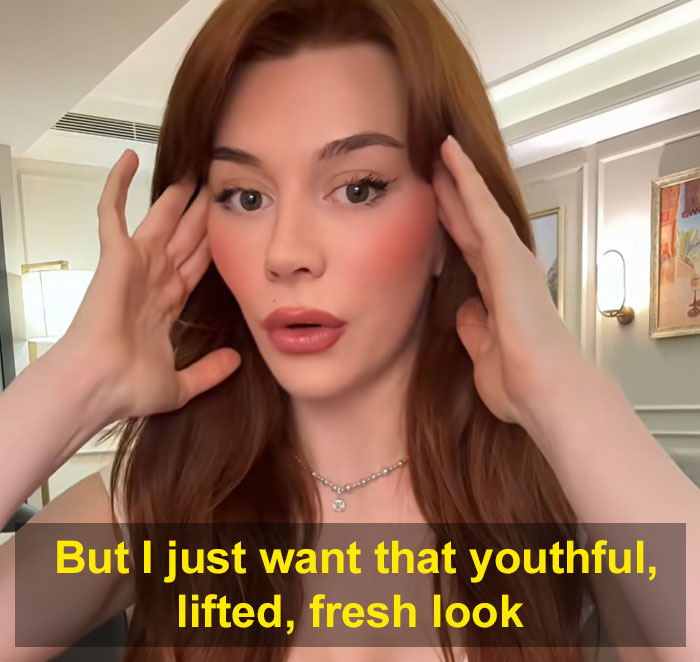 A young woman with red hair and makeup demonstrates a facelift result, touching her temples, for a youthful, lifted look.