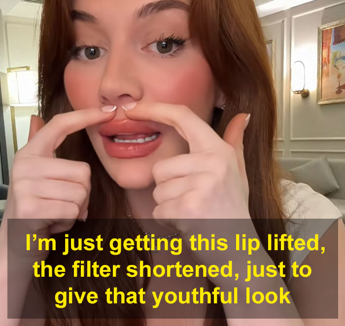 Woman showing facelift results, discussing her youthful look. This sparks debate on society's new normal regarding cosmetic surgery.