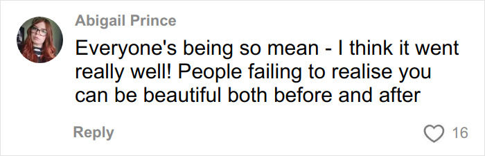 Comment from Abigail Prince defending a facelift, stating people can be beautiful before and after, amid the raging debate.