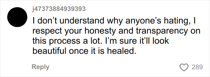 A comment from j473738849393 supporting the woman's honesty about her facelift, saying it will look beautiful.