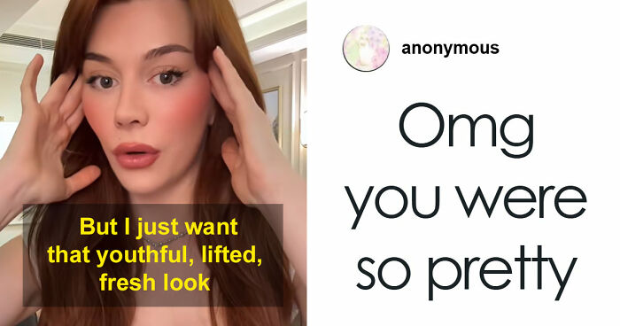 “Ridiculously Sad”: 28YO Woman’s Facelift Sparks Raging Debate As People Question Society’s New Normal