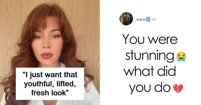 “Ridiculously Sad”: 28YO Woman’s Facelift Sparks Raging Debate As People Question Society’s New Normal