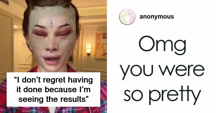 “Ridiculously Sad”: 28YO Woman’s Facelift Sparks Raging Debate As People Question Society’s New Normal