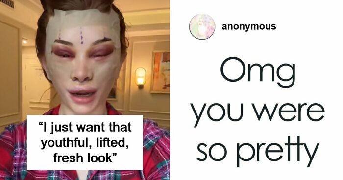 “Ridiculously Sad”: 28YO Woman’s Facelift Sparks Raging Debate As People Question Society’s New Normal