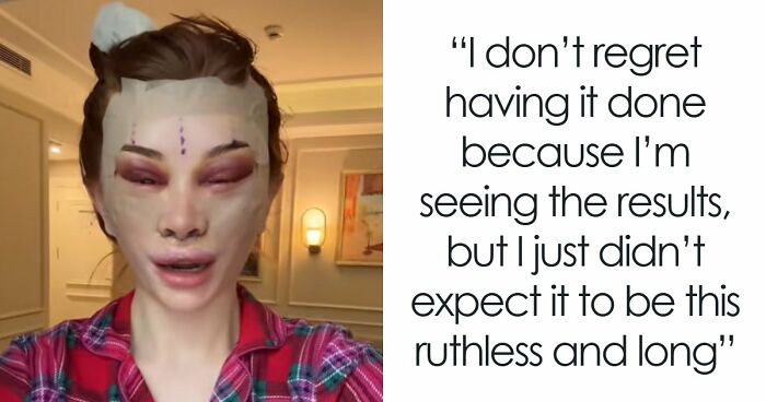 “Ridiculously Sad”: 28YO Woman’s Facelift Sparks Raging Debate As People Question Society’s New Normal