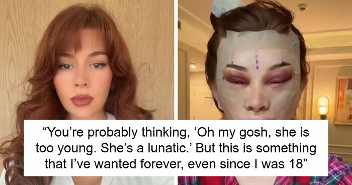 “Ridiculously Sad”: 28YO Woman’s Facelift Sparks Raging Debate As People Question Society’s New Normal