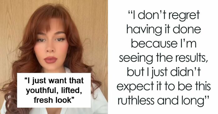 “Ridiculously Sad”: 28YO Woman’s Facelift Sparks Raging Debate As People Question Society’s New Normal
