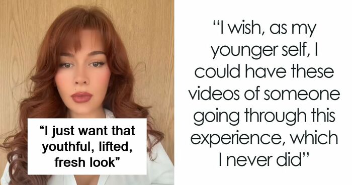 “Ridiculously Sad”: 28YO Woman’s Facelift Sparks Raging Debate As People Question Society’s New Normal