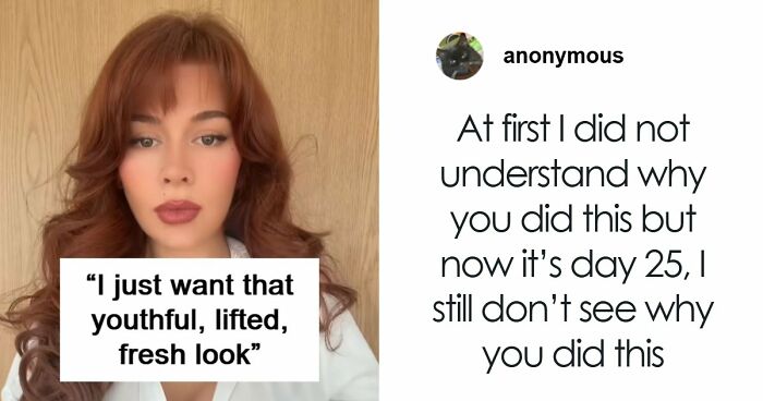 “Ridiculously Sad”: 28YO Woman’s Facelift Sparks Raging Debate As People Question Society’s New Normal
