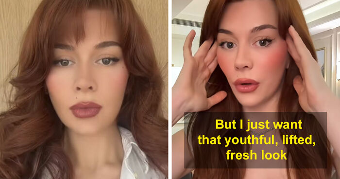 “Ridiculously Sad”: 28YO Woman’s Facelift Sparks Raging Debate As People Question Society’s New Normal