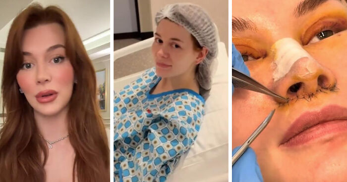 “Ridiculously Sad”: 28YO Woman’s Facelift Sparks Raging Debate As People Question Society’s New Normal