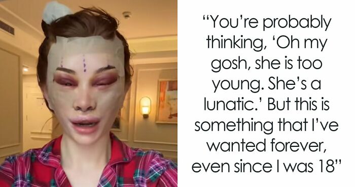 “Ridiculously Sad”: 28YO Woman’s Facelift Sparks Raging Debate As People Question Society’s New Normal