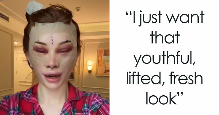 “Ridiculously Sad”: 28YO Woman’s Facelift Sparks Raging Debate As People Question Society’s New Normal