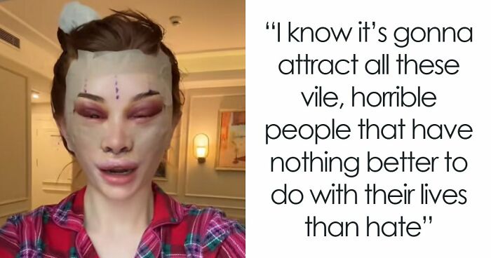 “Ridiculously Sad”: 28YO Woman’s Facelift Sparks Raging Debate As People Question Society’s New Normal