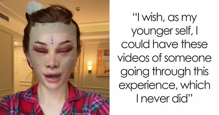 “Ridiculously Sad”: 28YO Woman’s Facelift Sparks Raging Debate As People Question Society’s New Normal