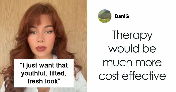 “Ridiculously Sad”: 28YO Woman’s Facelift Sparks Raging Debate As People Question Society’s New Normal