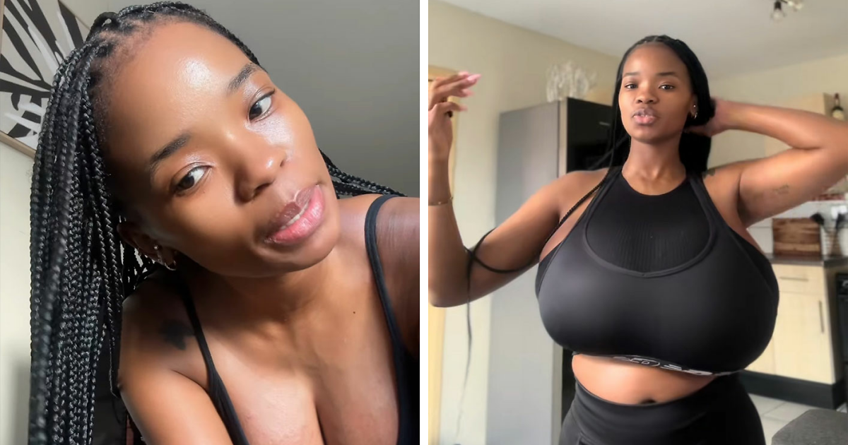 Woman’s Breasts Regrow After Undergoing Reduction, Leaving Internet Baffled