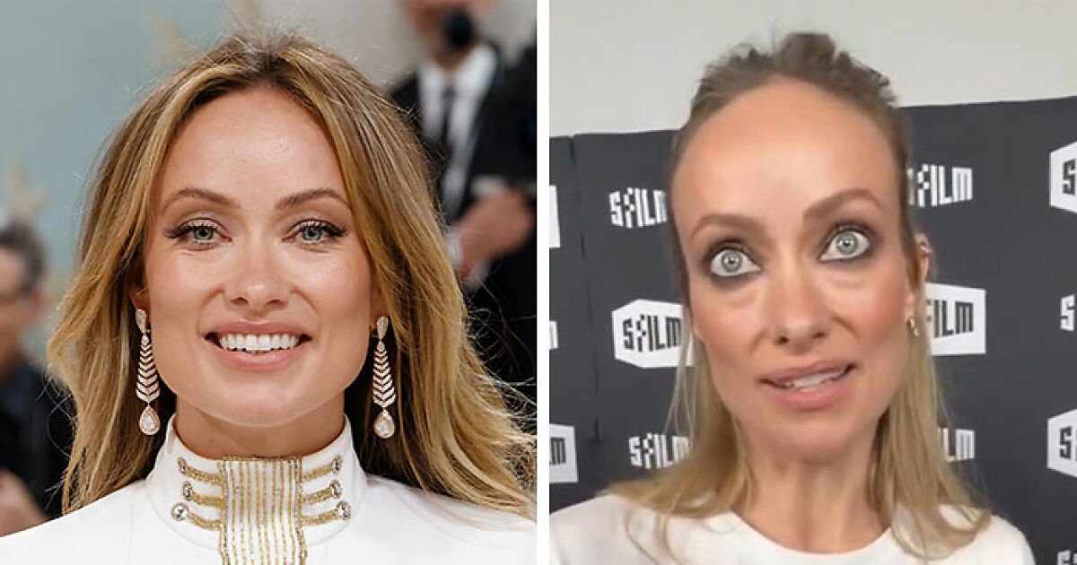 “Medical Cadaver”: Olivia Wilde’s Latest Appearance Triggers Major Concerns For Women In Hollywood