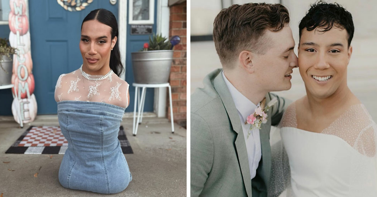Trans Influencer With No Limbs Reveals What “Everyone Wants To Know” About Life With Husband After Transitioning
