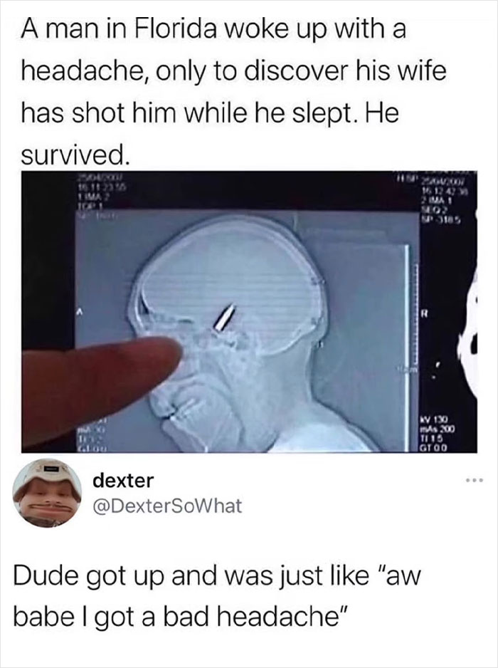 X-ray image showing a bullet in the head with a relatable meme about a bad headache and surviving a gunshot wound.