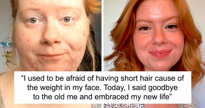 “There Is Hope”: 57 Glow-Ups So Extreme, People Barely Look Like The Same Person