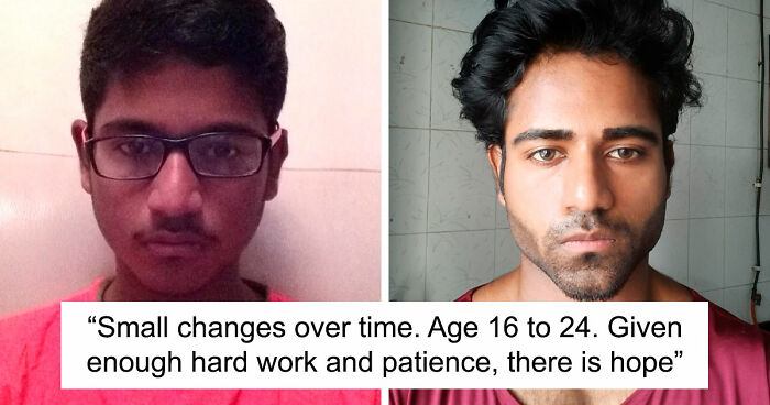 “There Is Hope”: 57 Glow-Ups So Extreme, People Barely Look Like The Same Person