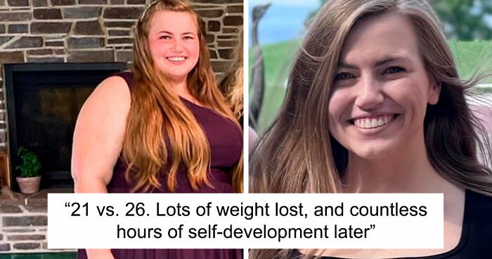 “There Is Hope”: 57 Glow-Ups So Extreme, People Barely Look Like The Same Person