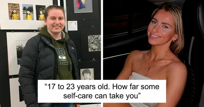 “There Is Hope”: 57 Glow-Ups So Extreme, People Barely Look Like The Same Person