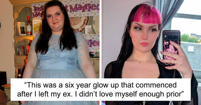 “There Is Hope”: 57 Glow-Ups So Extreme, People Barely Look Like The Same Person