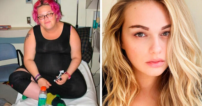 “There Is Hope”: 57 Glow-Ups So Extreme, People Barely Look Like The Same Person