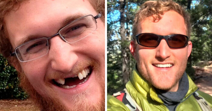 “There Is Hope”: 57 Glow-Ups So Extreme, People Barely Look Like The Same Person