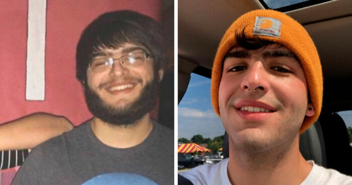 “There Is Hope”: 57 Glow-Ups So Extreme, People Barely Look Like The Same Person