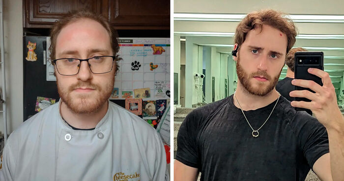 “There Is Hope”: 57 Glow-Ups So Extreme, People Barely Look Like The Same Person