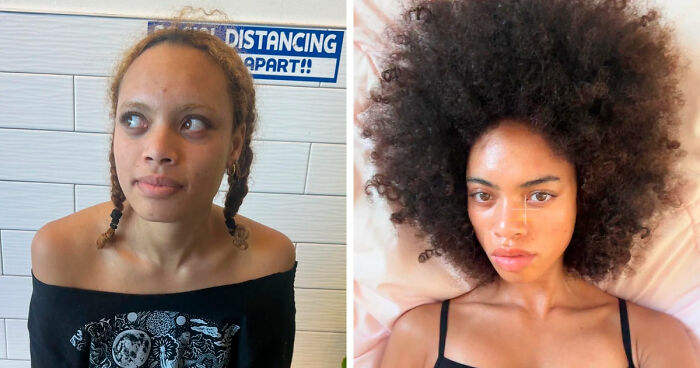 “There Is Hope”: 57 Glow-Ups So Extreme, People Barely Look Like The Same Person