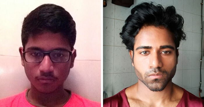 “There Is Hope”: 57 Glow-Ups So Extreme, People Barely Look Like The Same Person